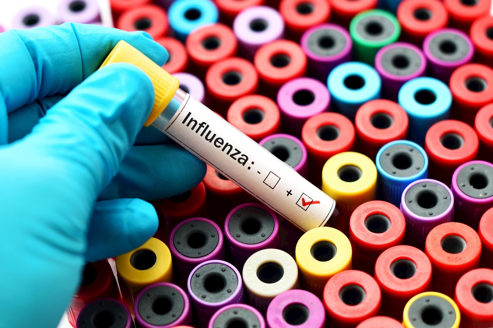 Filipinas registra surto de Influenza Aviária em granja de codornas