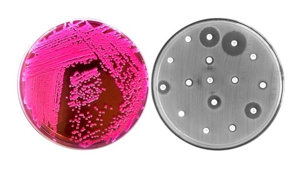 Encontrada no Brasil bactéria resistente a um dos mais poderosos antibióticos