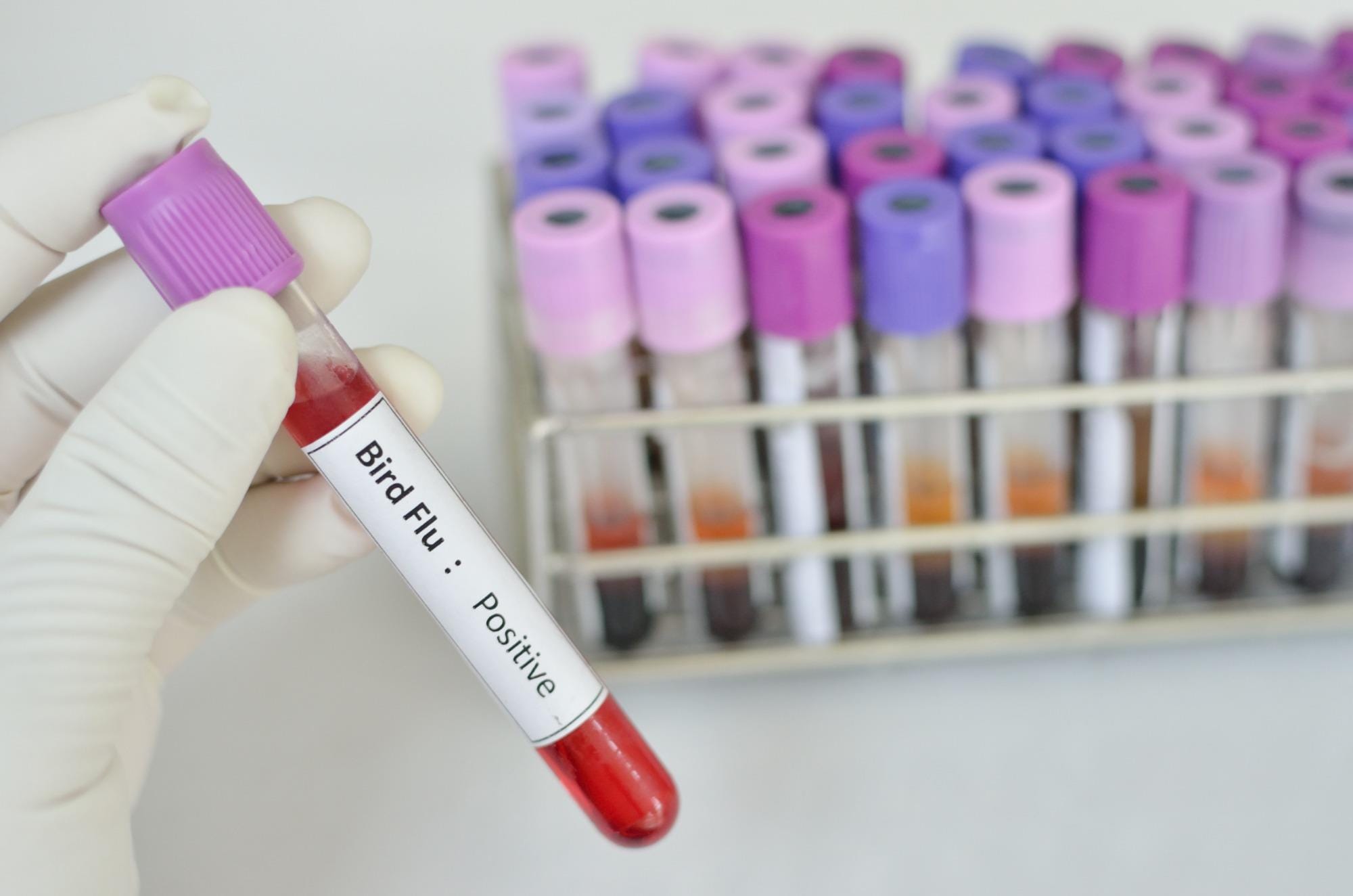 Novo registro de gripe aviária no Paraná eleva total no Brasil para 77