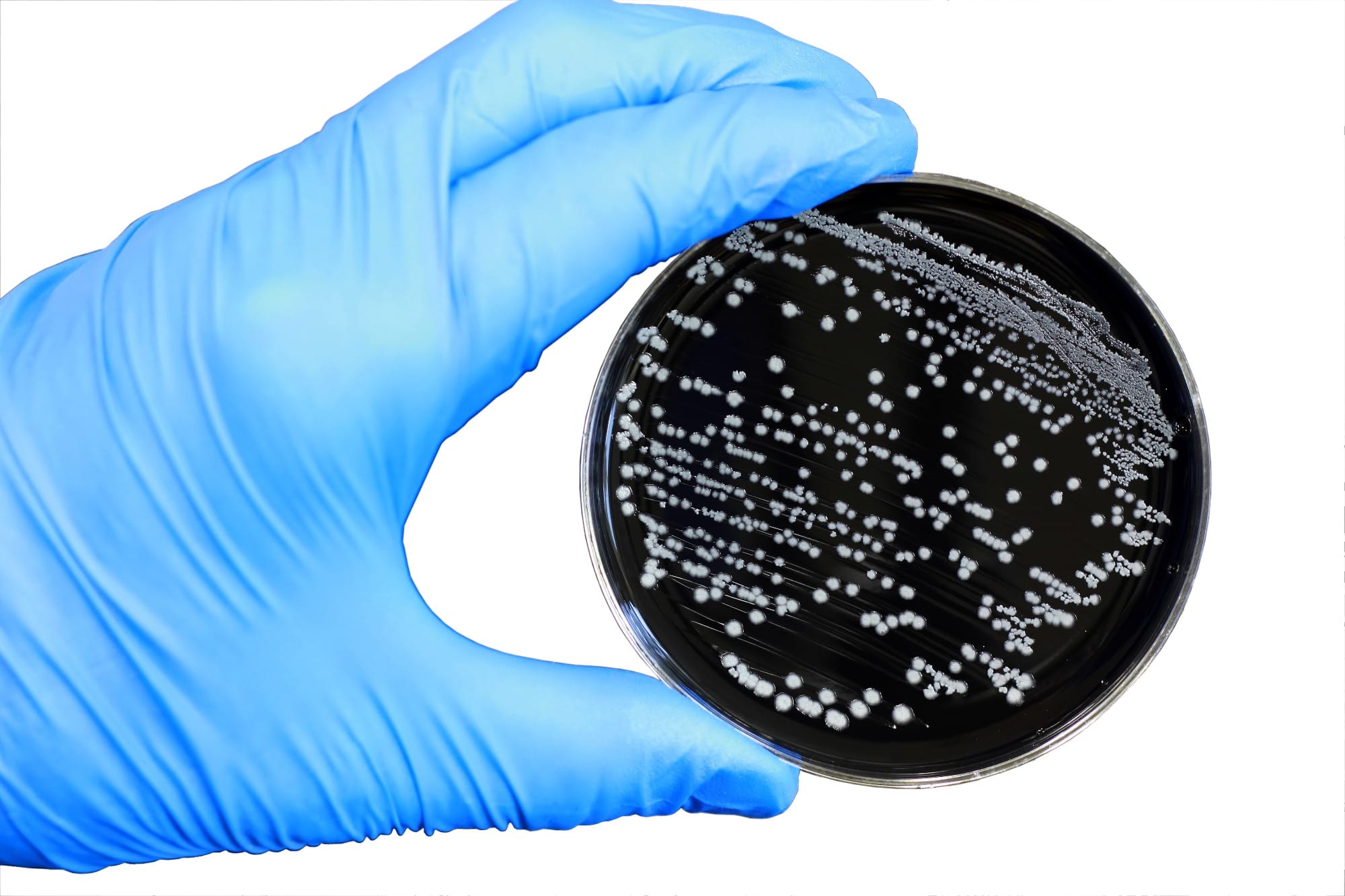 Antimicrobianos, os novos poluentes?