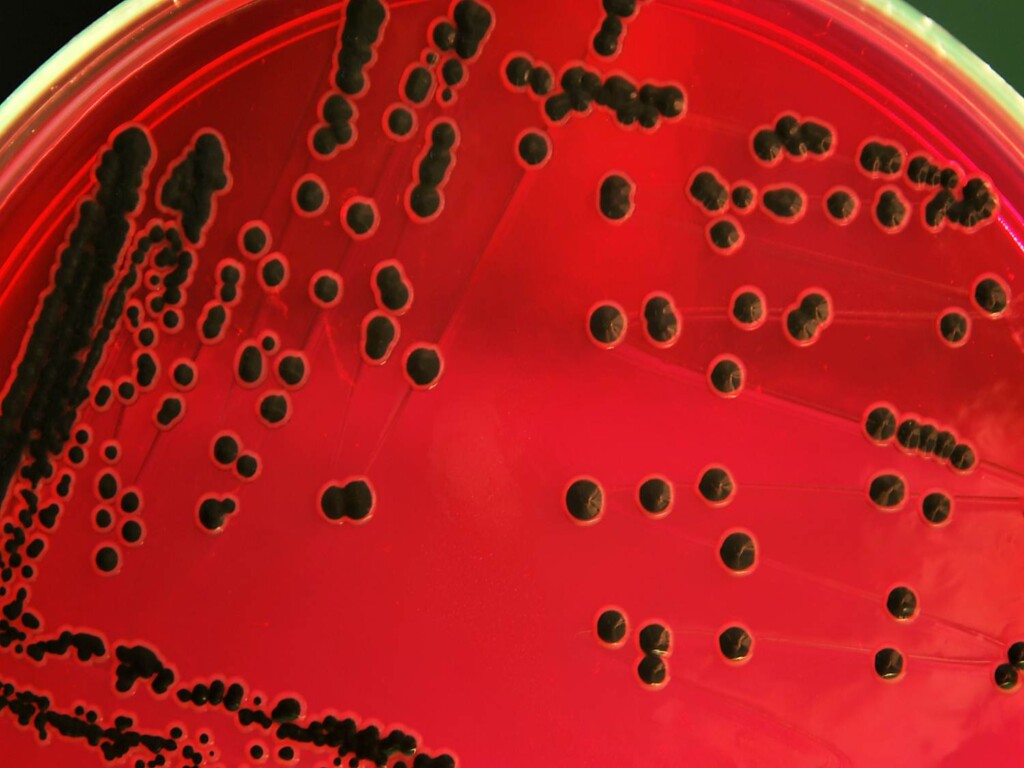 Salmonela e o controle integrado na cadeia produtiva de proteína animal