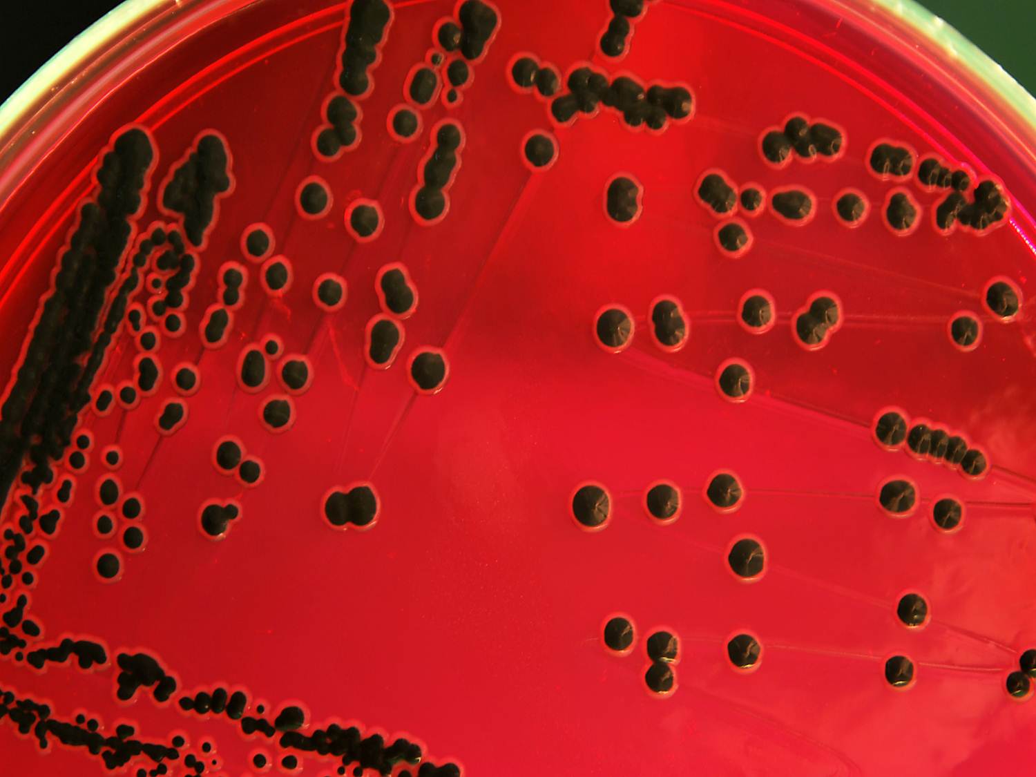 Salmonela e o controle integrado na cadeia produtiva de proteína animal
